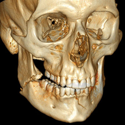 3D-CT