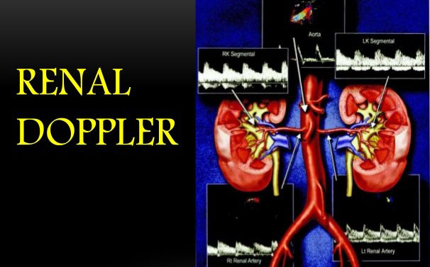 renal-doppler