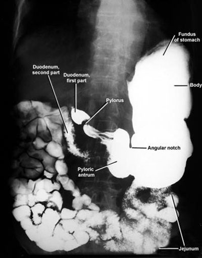 special-x-ray