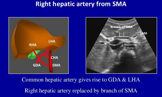 USG-HEPATIC-DOPPLER 