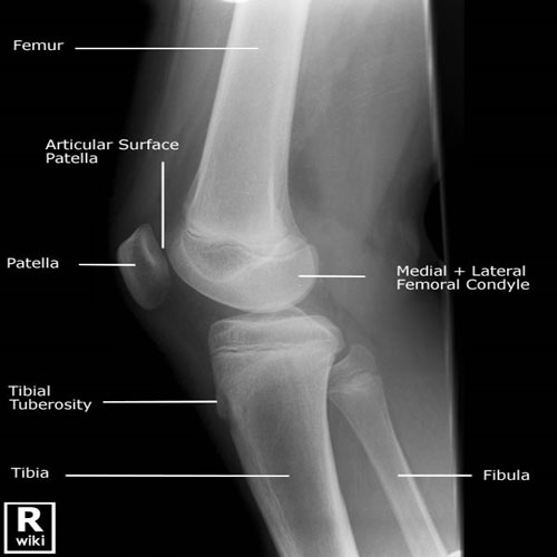 x-ray-joint