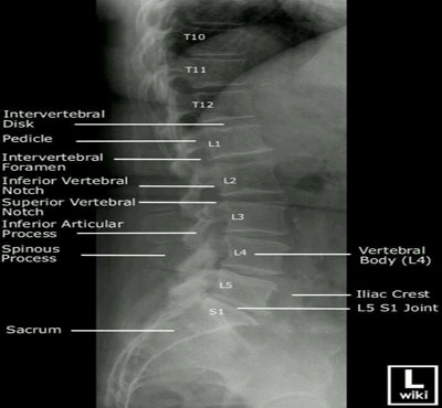 x-ray-spine