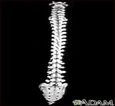 x-ray-spine